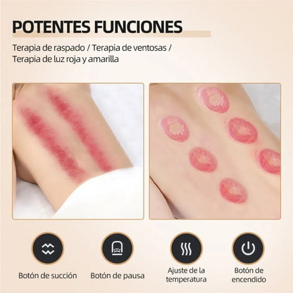 CuppingPro | Instrumento para Ventosas Eléctricas